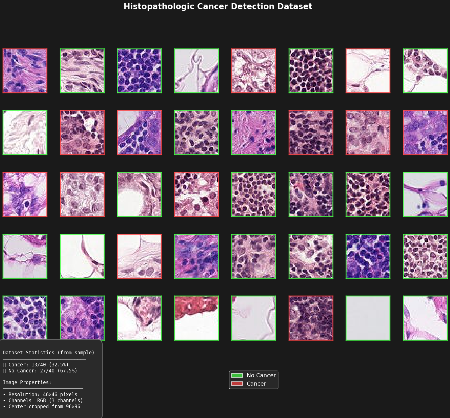 Histopathologic CapsuleNet